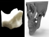시지바이오, 3D프린팅 맞춤형 인공광대뼈 제조허가 승인