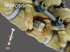 시지바이오, 새로운 골대체제 ‘노보시스 퍼티’ 유효성·안전성 입증